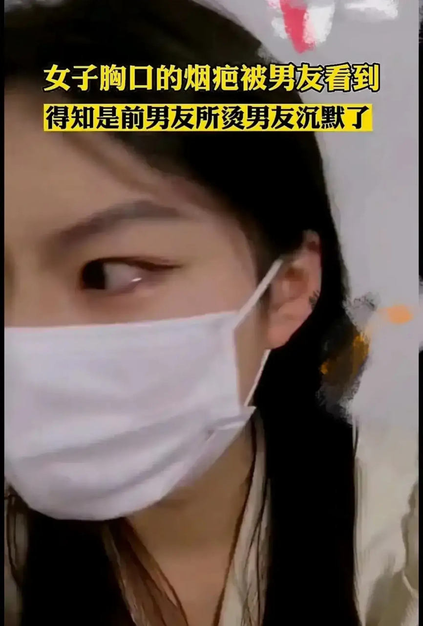 河南,男子脱下女友的内衣后,发现女友胸口有个疤痕icon,好奇之下就问