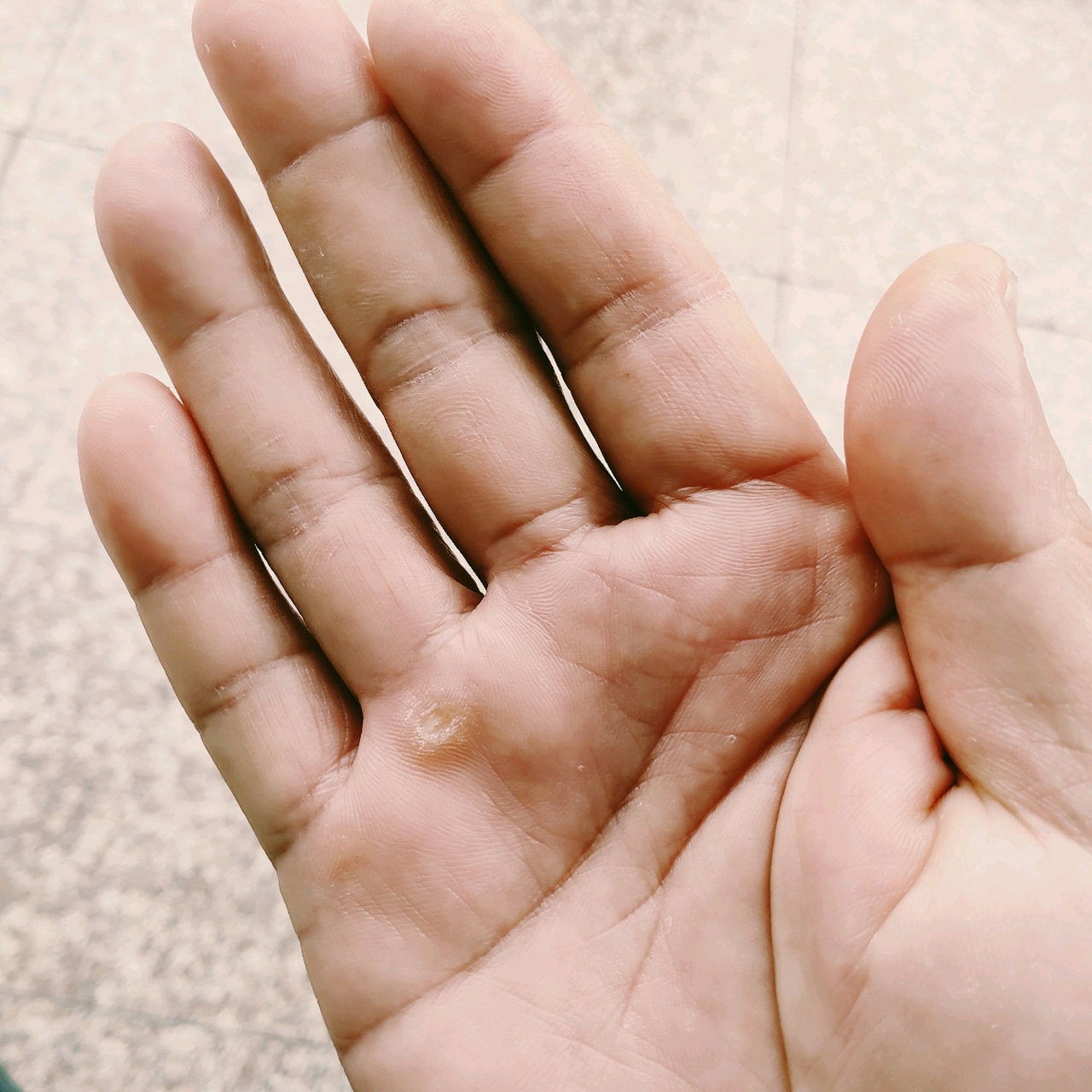 为什么我的手也起茧了?