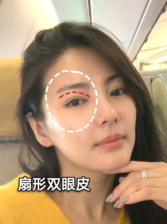 张雨绮的扇形双眼皮宛若新生,怎样做出又好看又自然的双眼皮?
