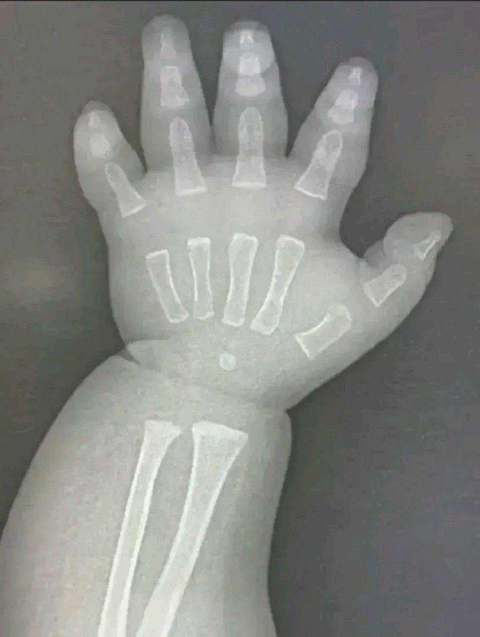 小孩子的骨头为什么没有连接起来呢?