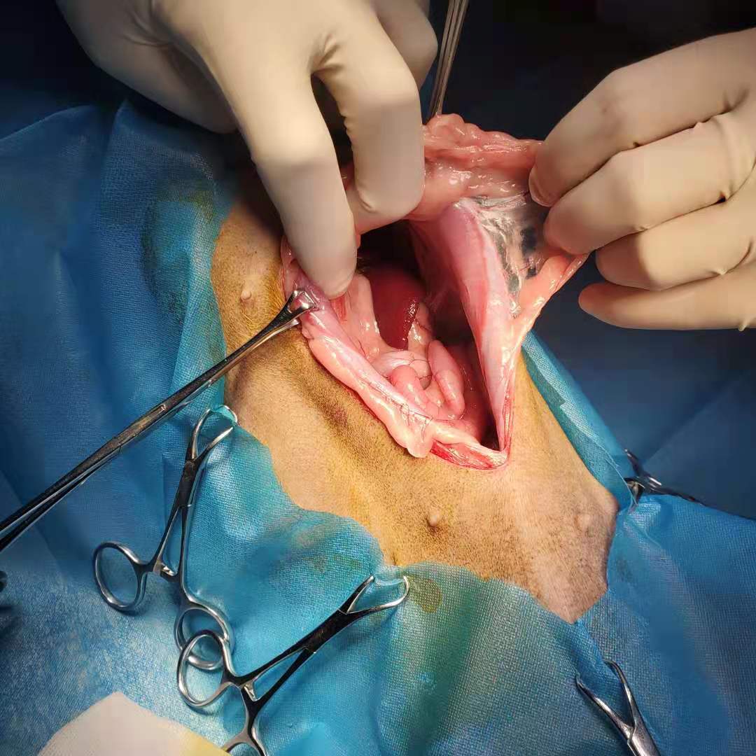 膈肌破裂手术修复