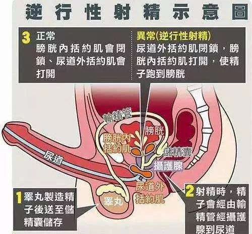 前列腺工作原理图图片