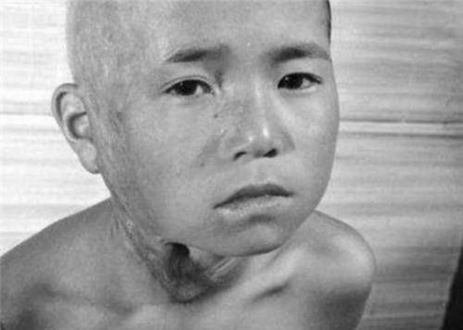 二战末期,美国在日本广岛,长崎各投放了一颗原子弹,导致十几万人当场