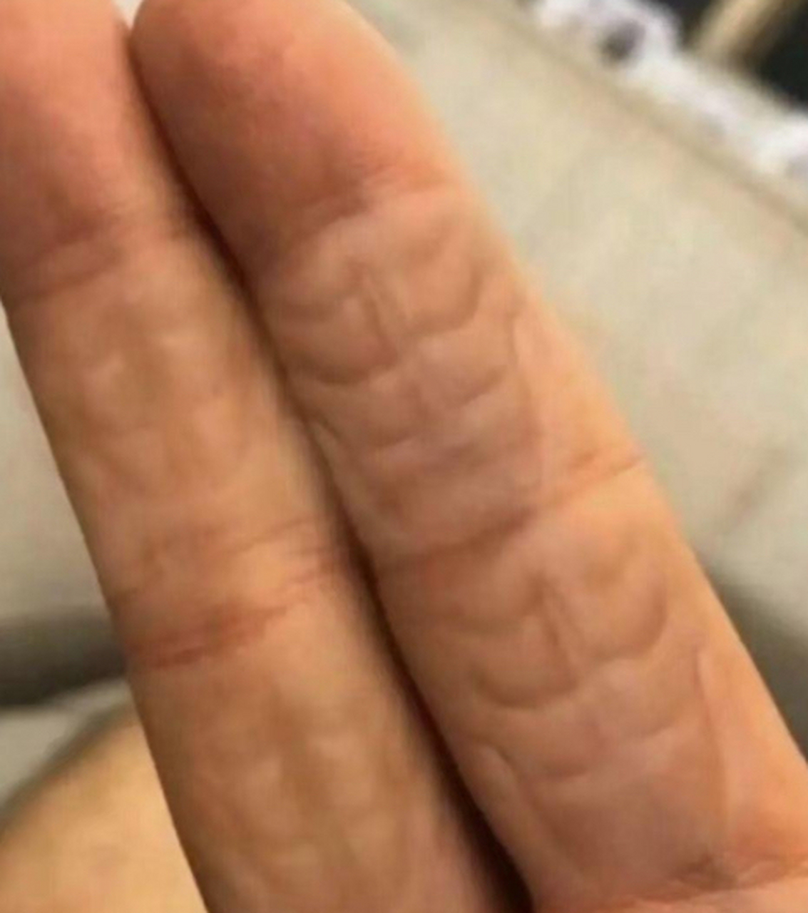 苦练后才发现不但小臂有了腹肌,手指也长出了腹肌