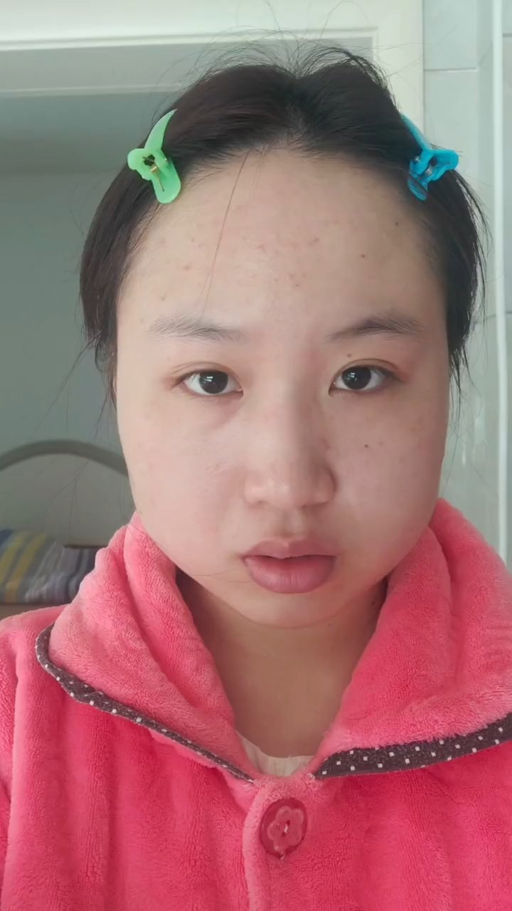 感觉摆脱了甲减困扰,变个了人似的!