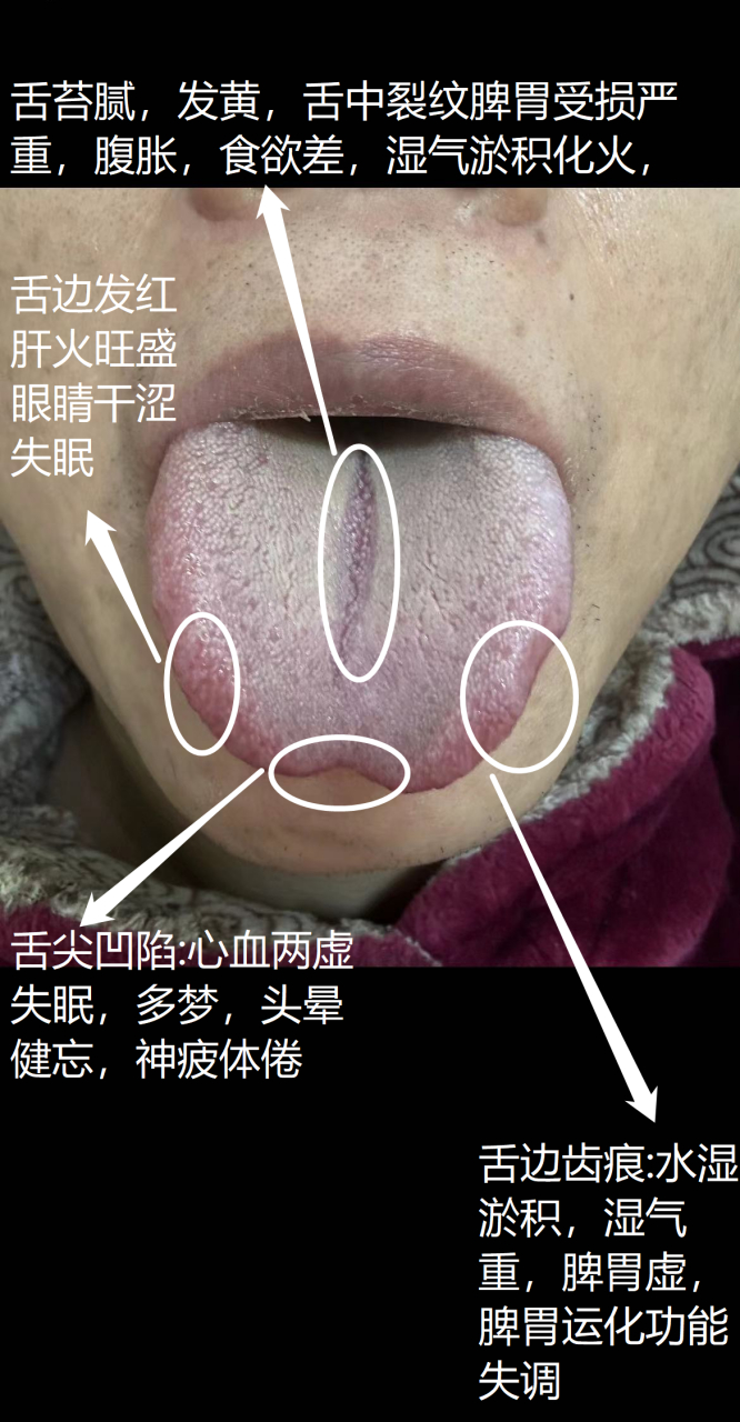 粉丝问诊舌像,你起来学习吧#中医# #中医养生# #肾虚