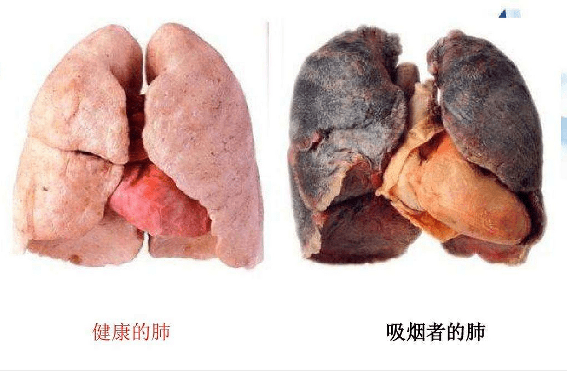 烟盒上的「吸烟有害健康」是否是在打马虎眼?