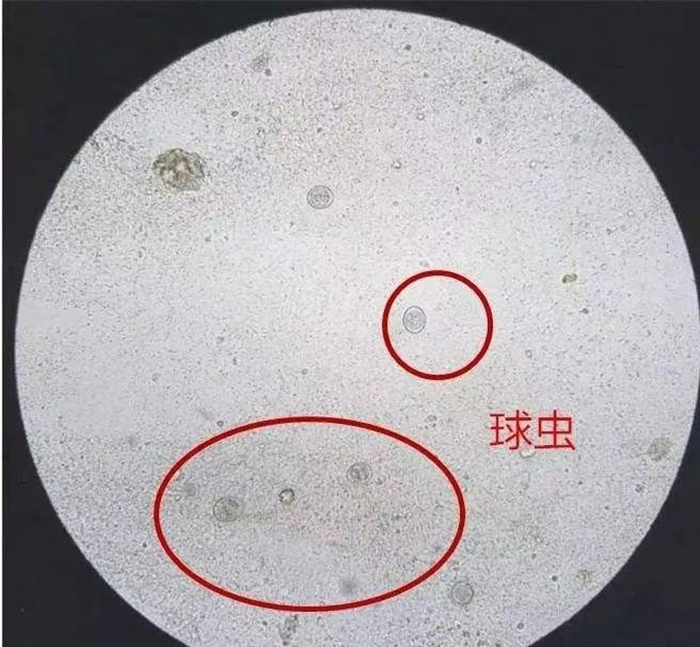 并且,球虫卵囊的囊壁有 2 层,外层为保护性膜,结实,有较大的弹性,化学