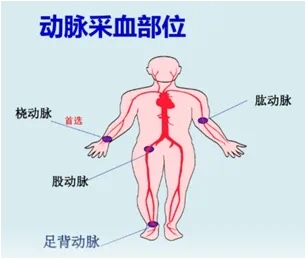 桡动脉血气扎多深图片