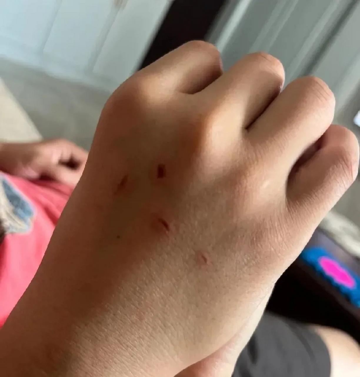 我怀疑是十指相扣的掐痕,他死不承认,硬说十指相扣不会是这样的掐酆 
