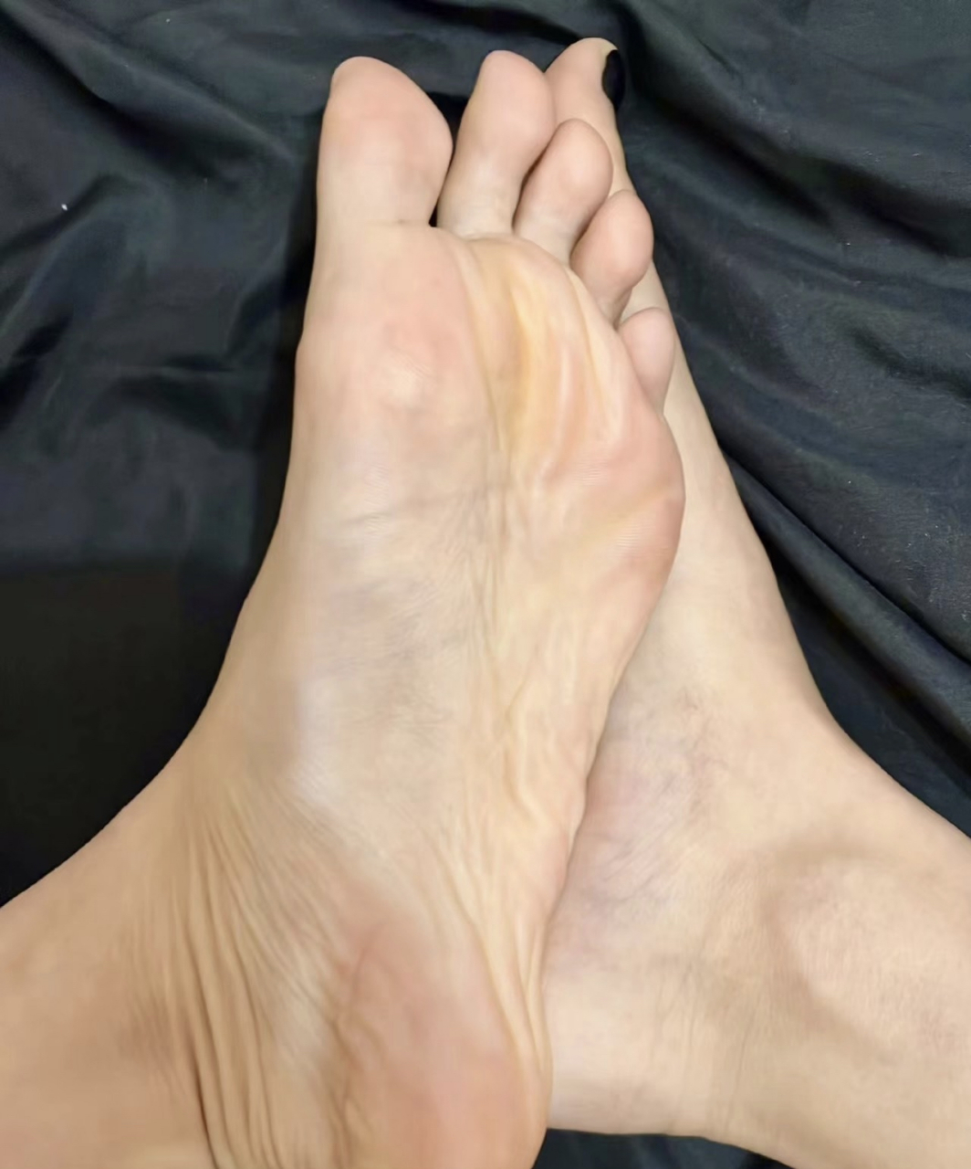 脚底发黄,怎么解决啊?有没有什么办法?