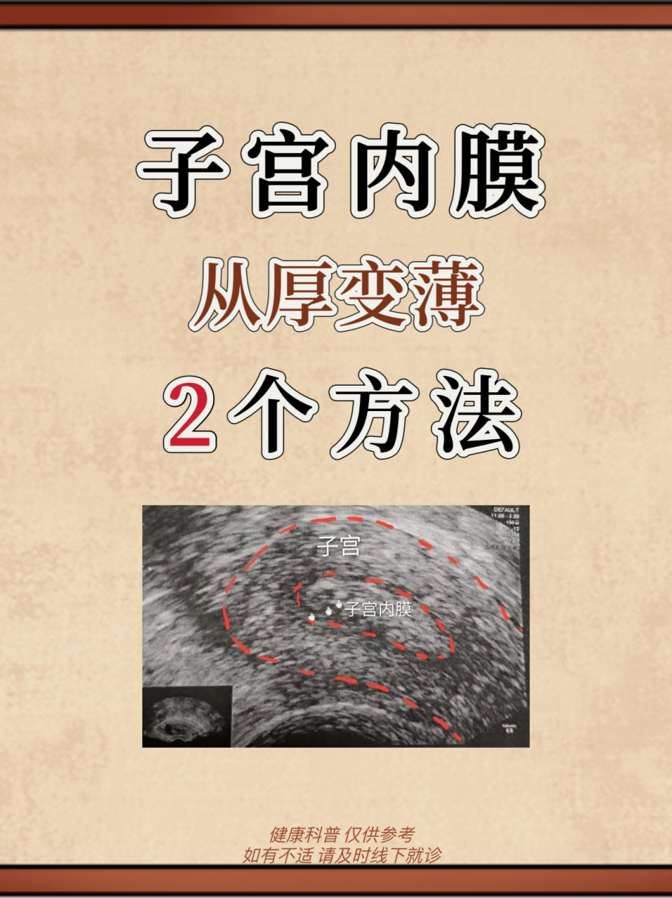 只发一次[no]  很多朋友都知道子宫内膜薄不好,检查出来子宫内膜增厚