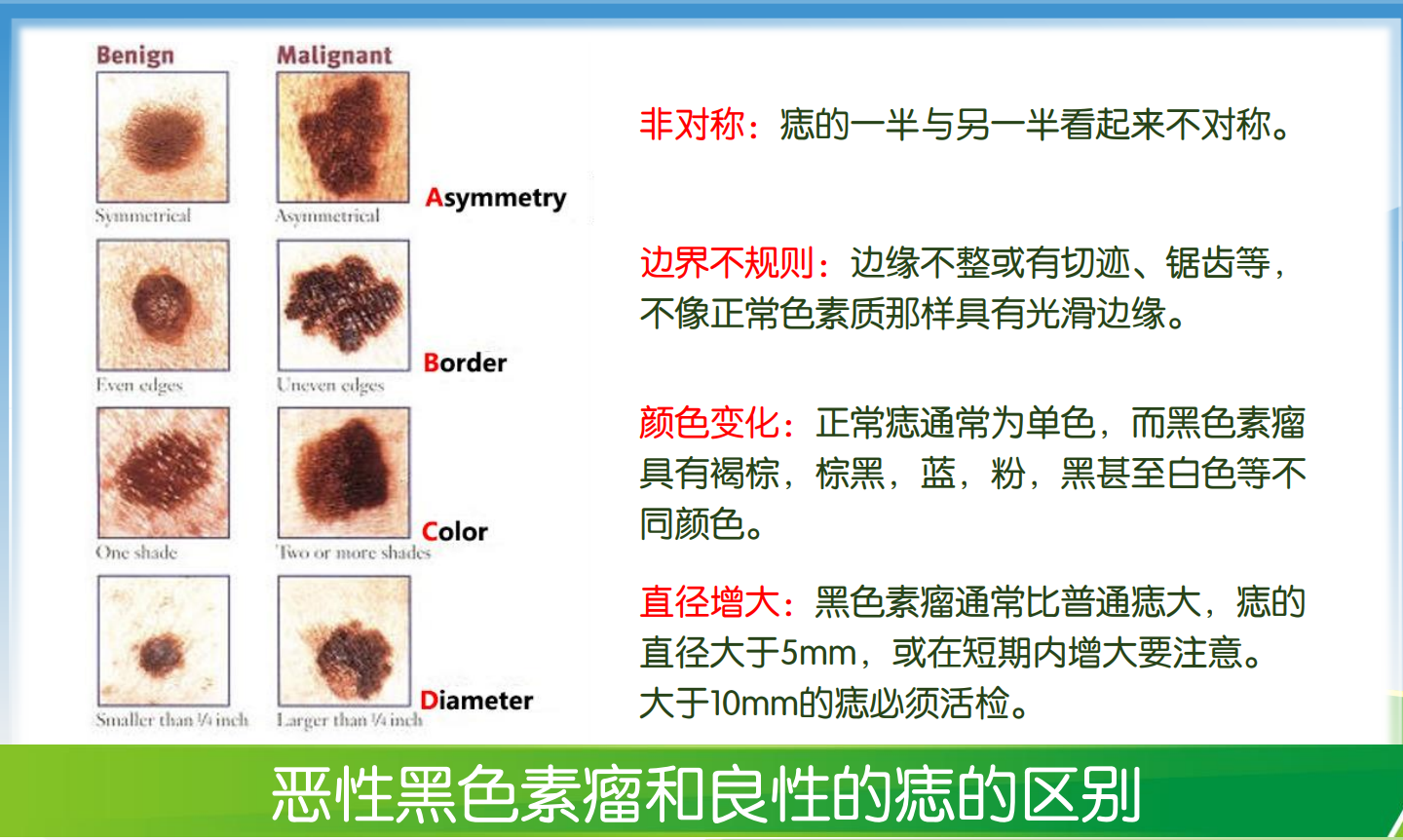 黑色素瘤的预防和治疗