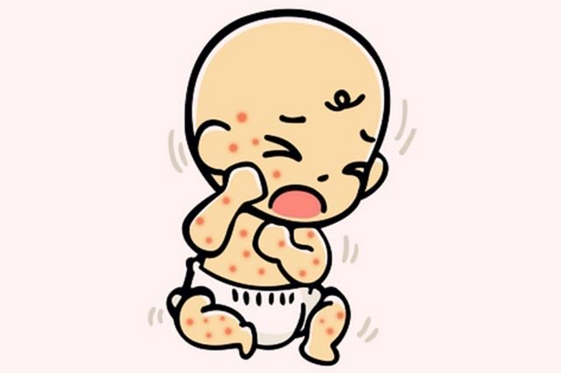 标题:〈宝宝湿疹有妙招〉 湿疹是婴幼儿时期最常见的皮肤问题之一,有