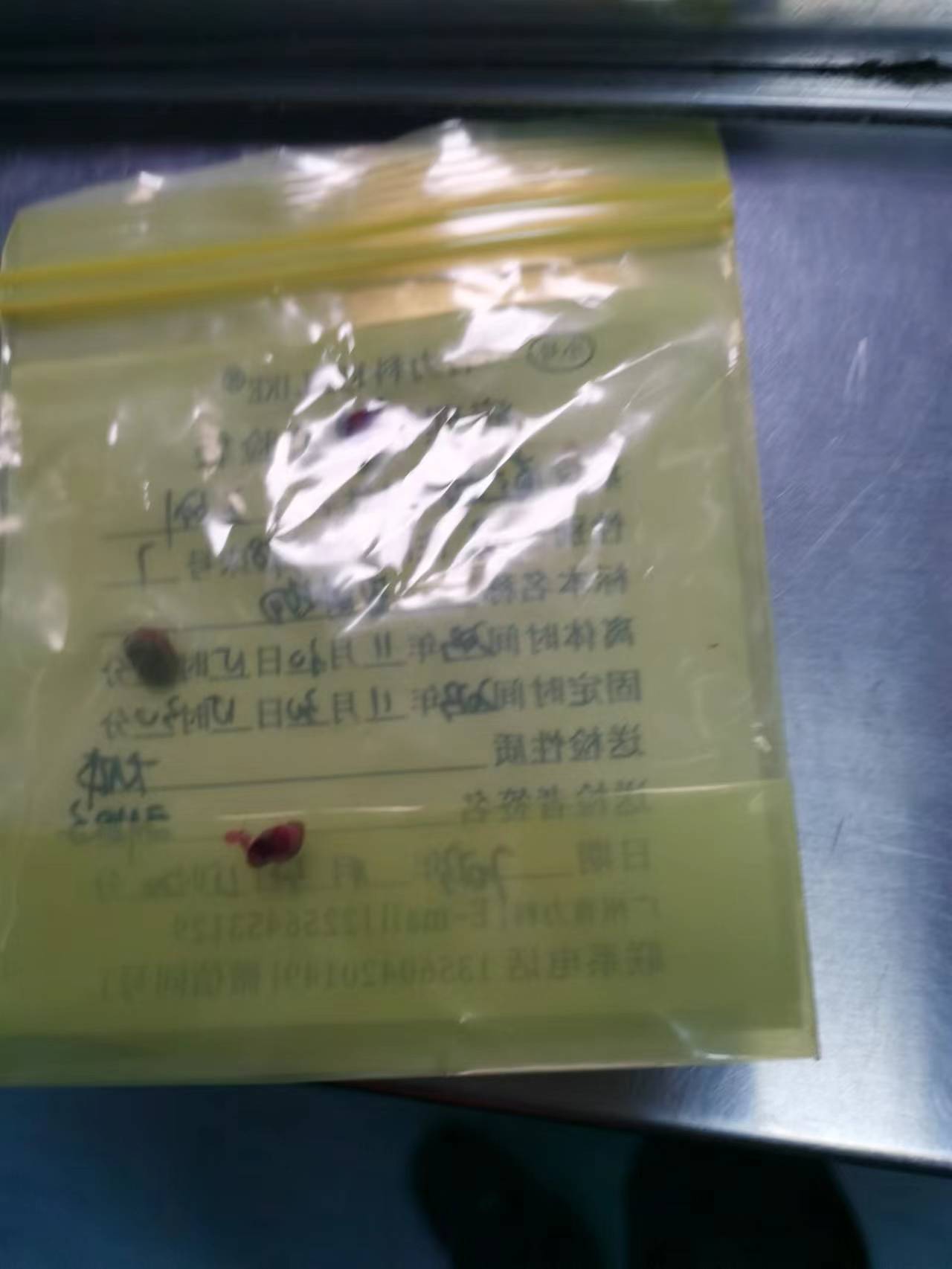 老公生病了每年都要做肠息肉胃息肉今年做了两次真让人担心