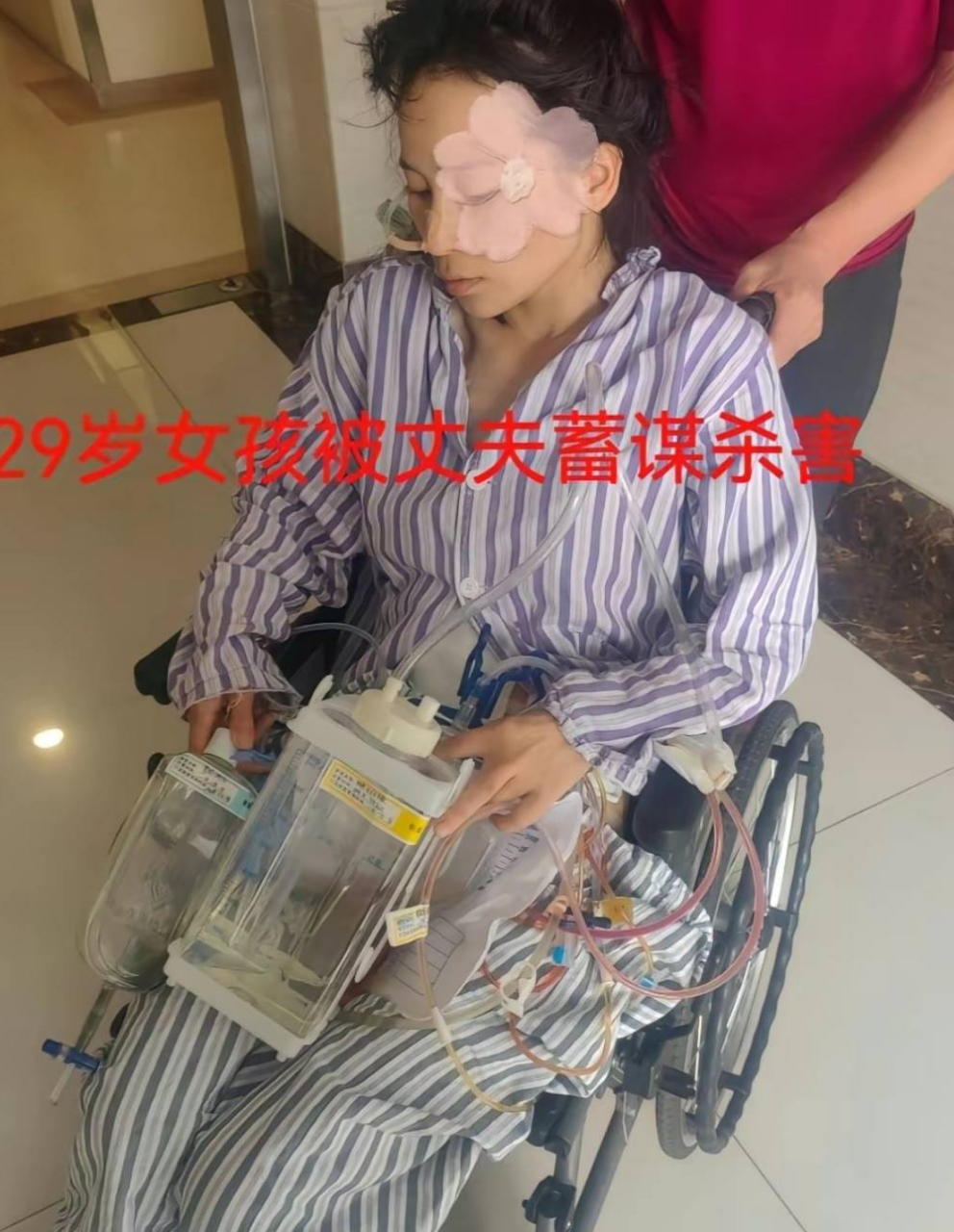 女子被丈夫家暴16次需终身挂粪袋,亲戚成帮凶!