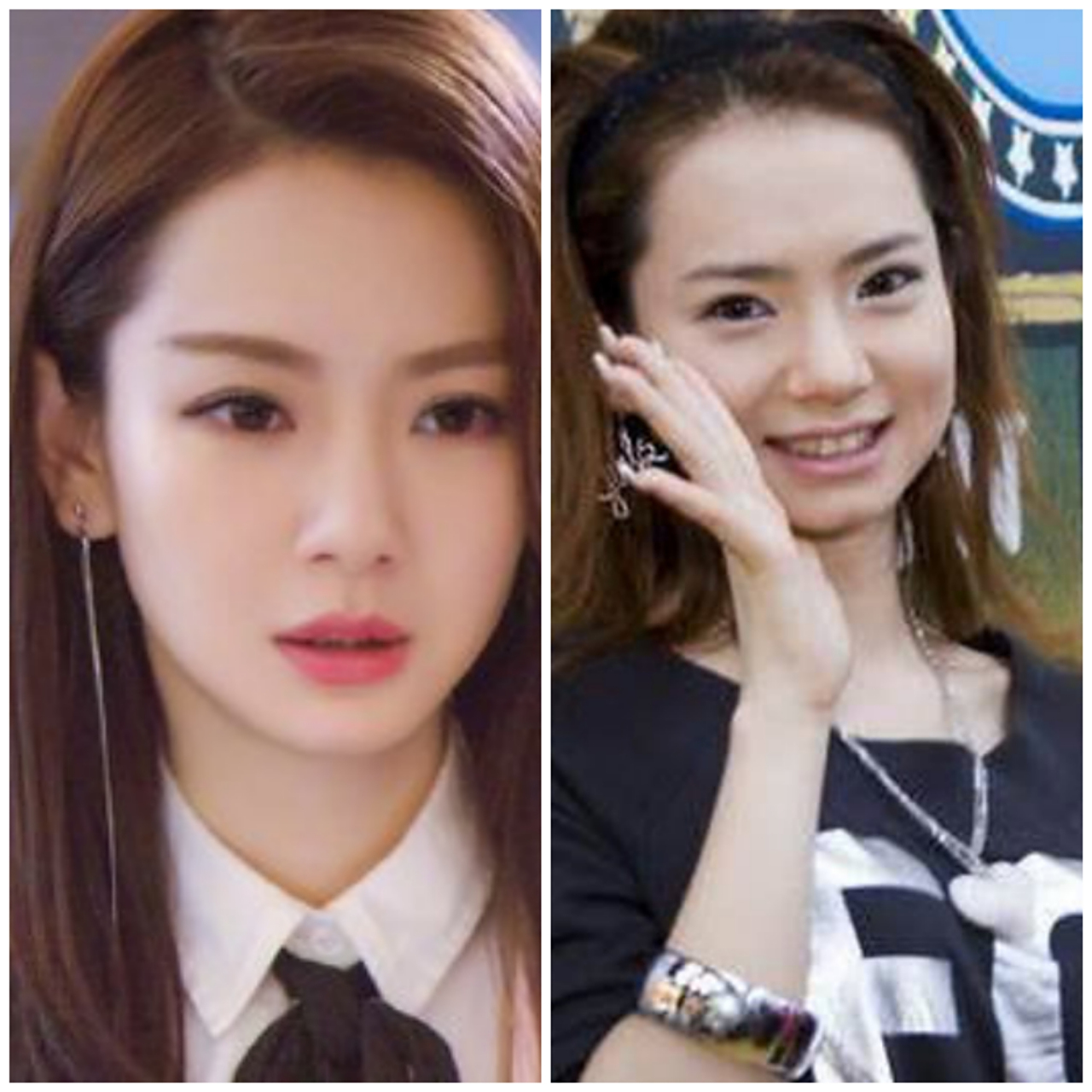 戚薇矫正牙齿后更美了