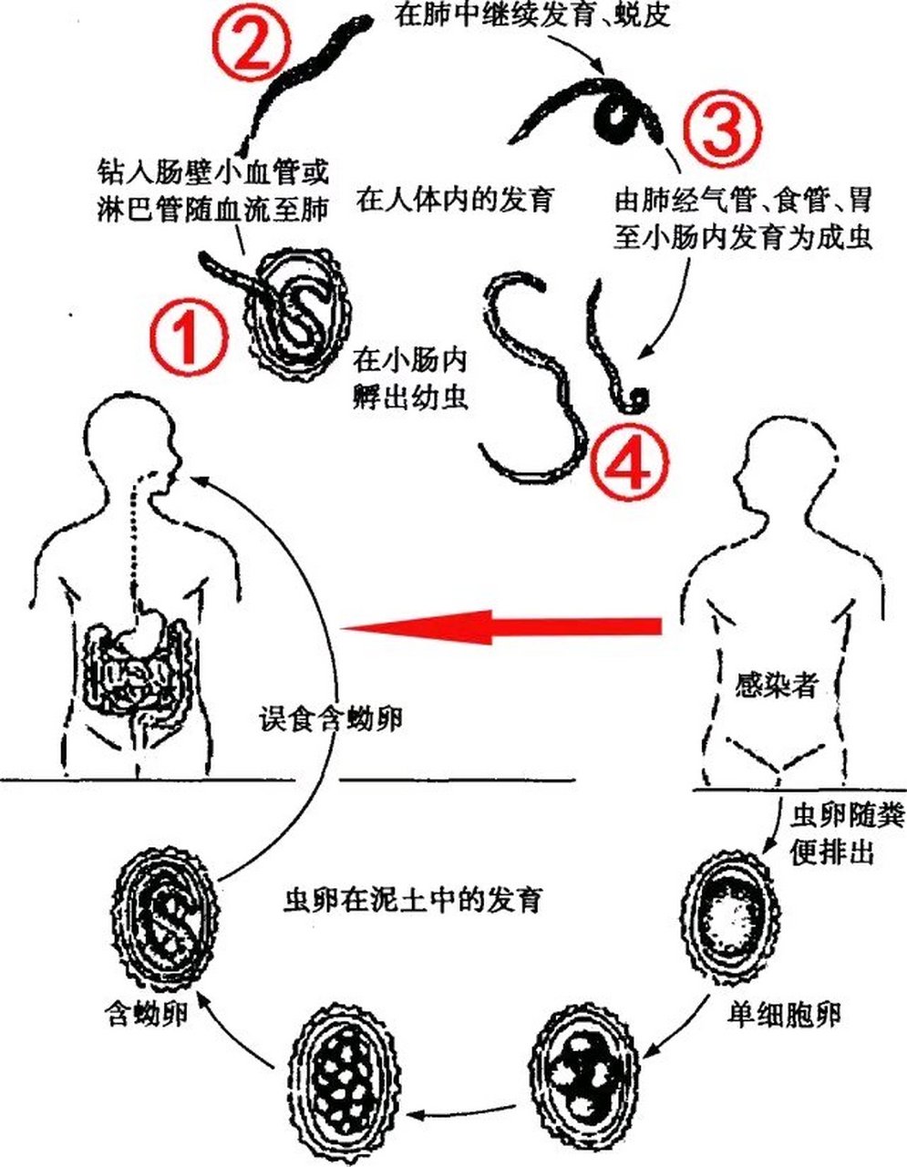 人体最大寄生虫图片