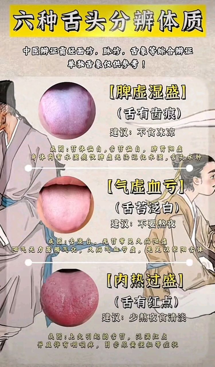 脾胃虚寒6种舌象分辨体质: 1,脾虚湿盛(舌有齿痕) 苔体偏白,舌苔偏白,