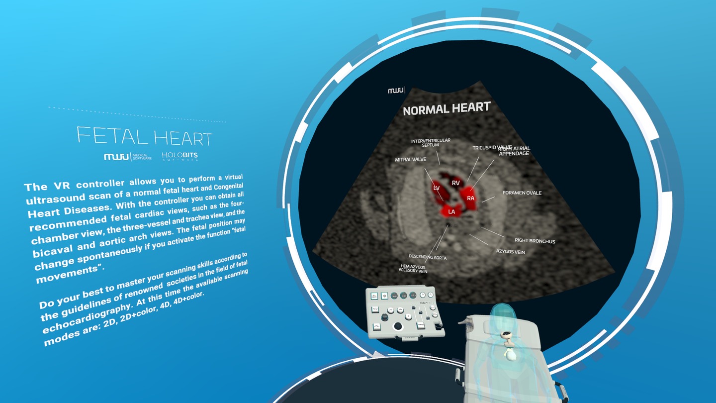 《心脏病医学VR》Fetal Heart VR