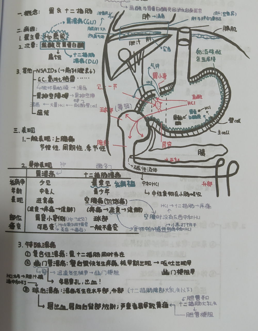 消化性溃疡手抄报图片