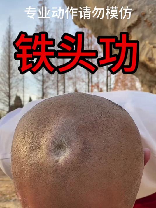 少林铁头功