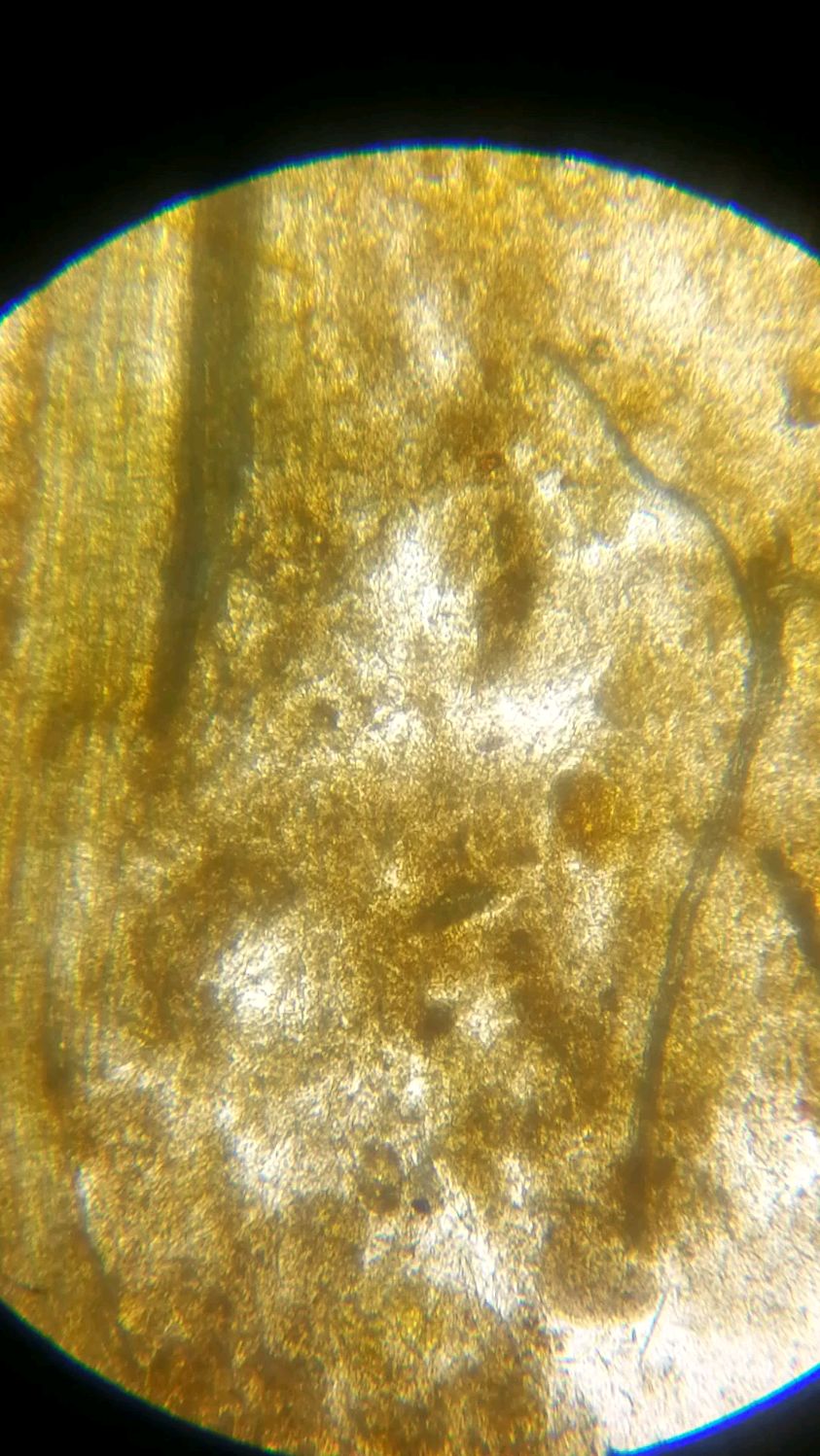 显微镜下的粑粑一看看你们自己的看看昨天都吃了啥