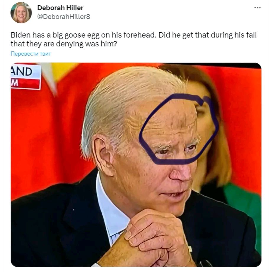 拜登是"瞌睡乔"还是"磕倒乔"登机时接连摔跤,头磕出大黑包!