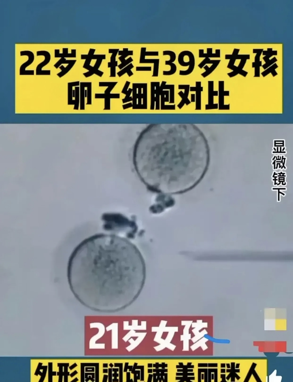 看到这个不同年龄的女性卵子显微镜下对比照片,我明白了:为什么男人都