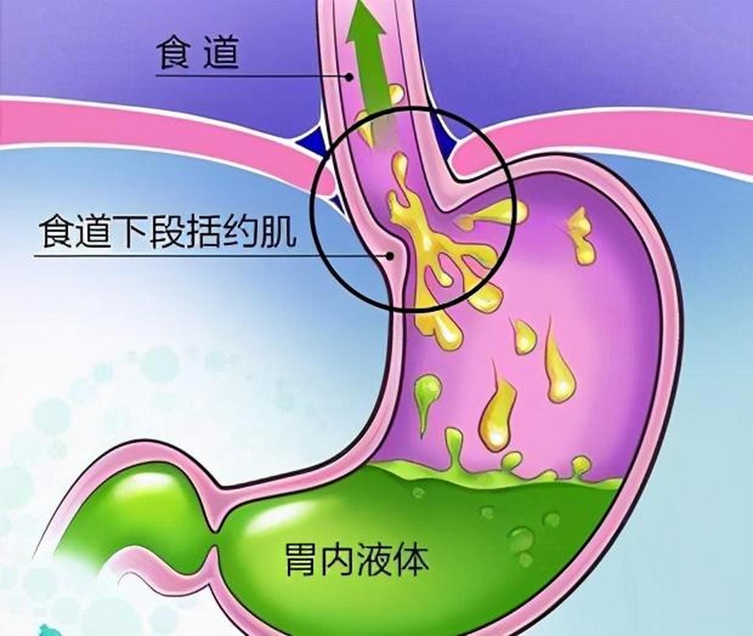 胃贲门部位图图片