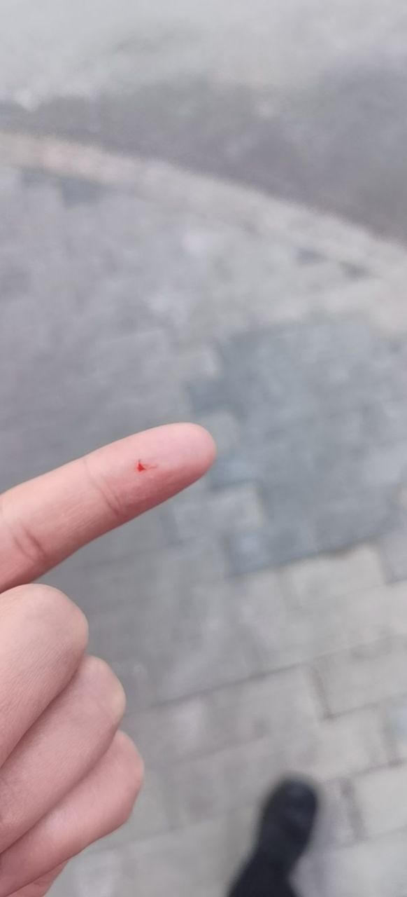 我让老鼠咬了但是打疫苗要828,小伤口还用打吗?