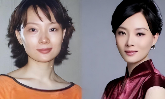 这一次,靠整容吃尽红利的陈数,最后还是迎来了"反噬"