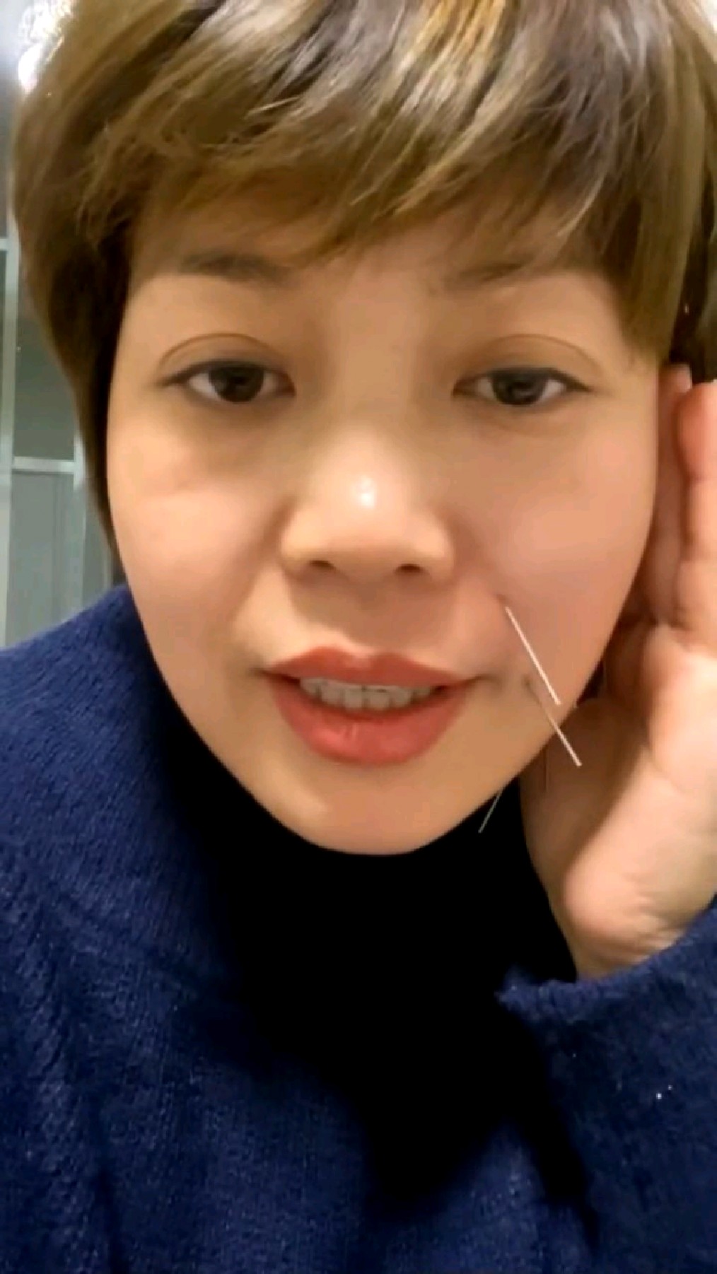 杭州针灸美雕效果好不好乔小平针灸美雕-度小视
