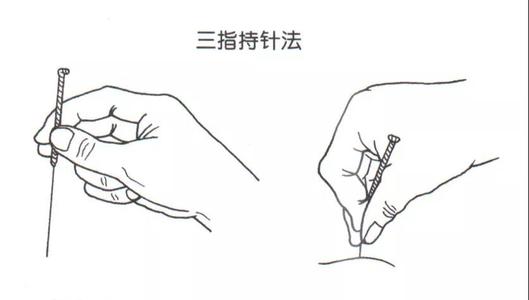 针刺前准备及破皮进针法