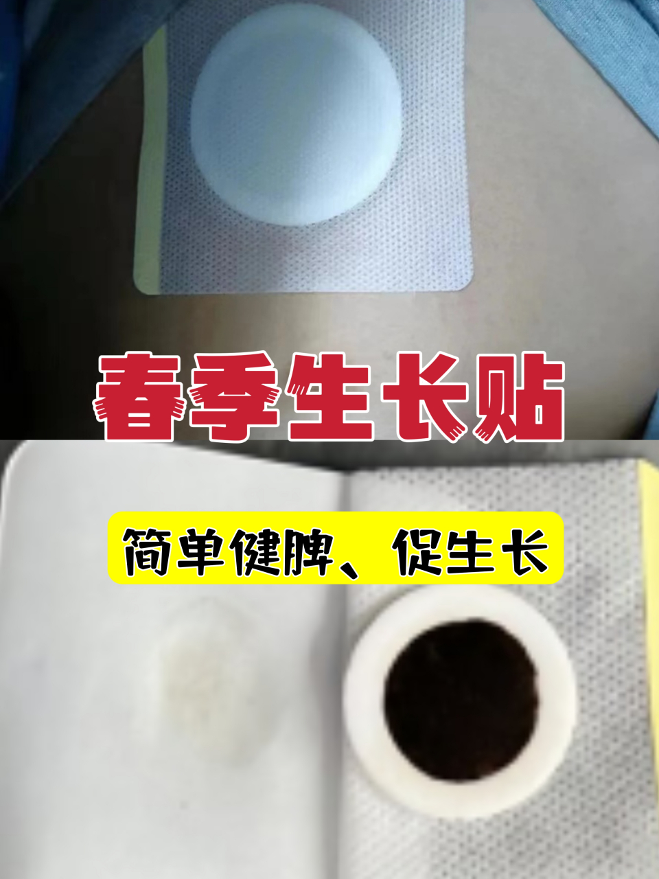 春季生长贴,有以下任何1种情况导致个子矮,长得慢,睡前贴敷6-8小时