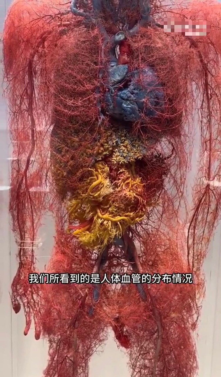 被人体血管的分布震惊到了.#趣图搞笑