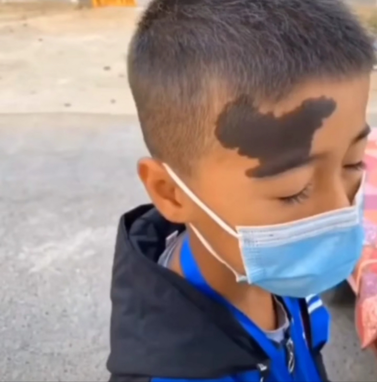 儿子头上这个胎记,他根本不想去掉.