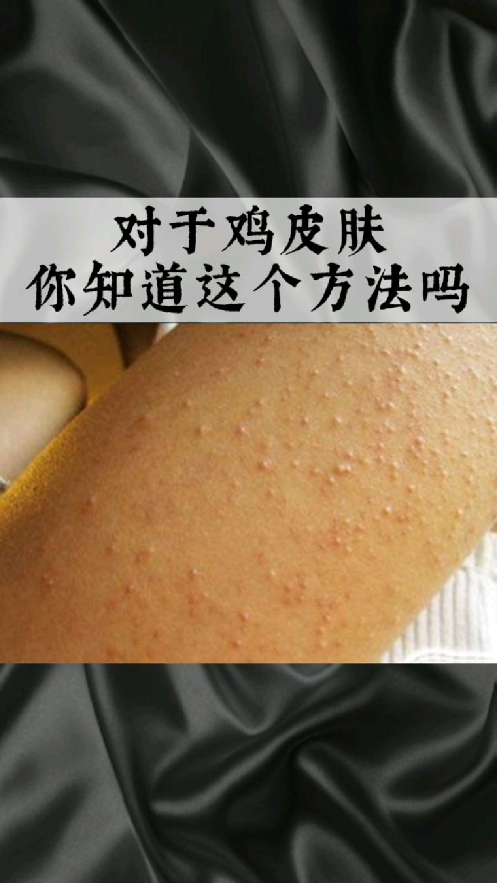 鸡皮肤可以涂粉底吗(鸡皮肤可以涂粉底吗女)