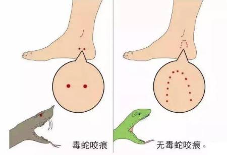 如何区别毒蛇和无毒蛇