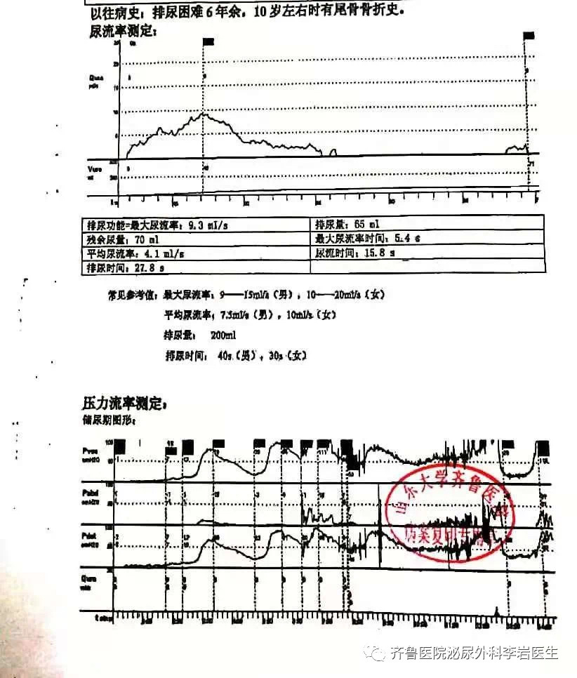 顽疾简谱图片