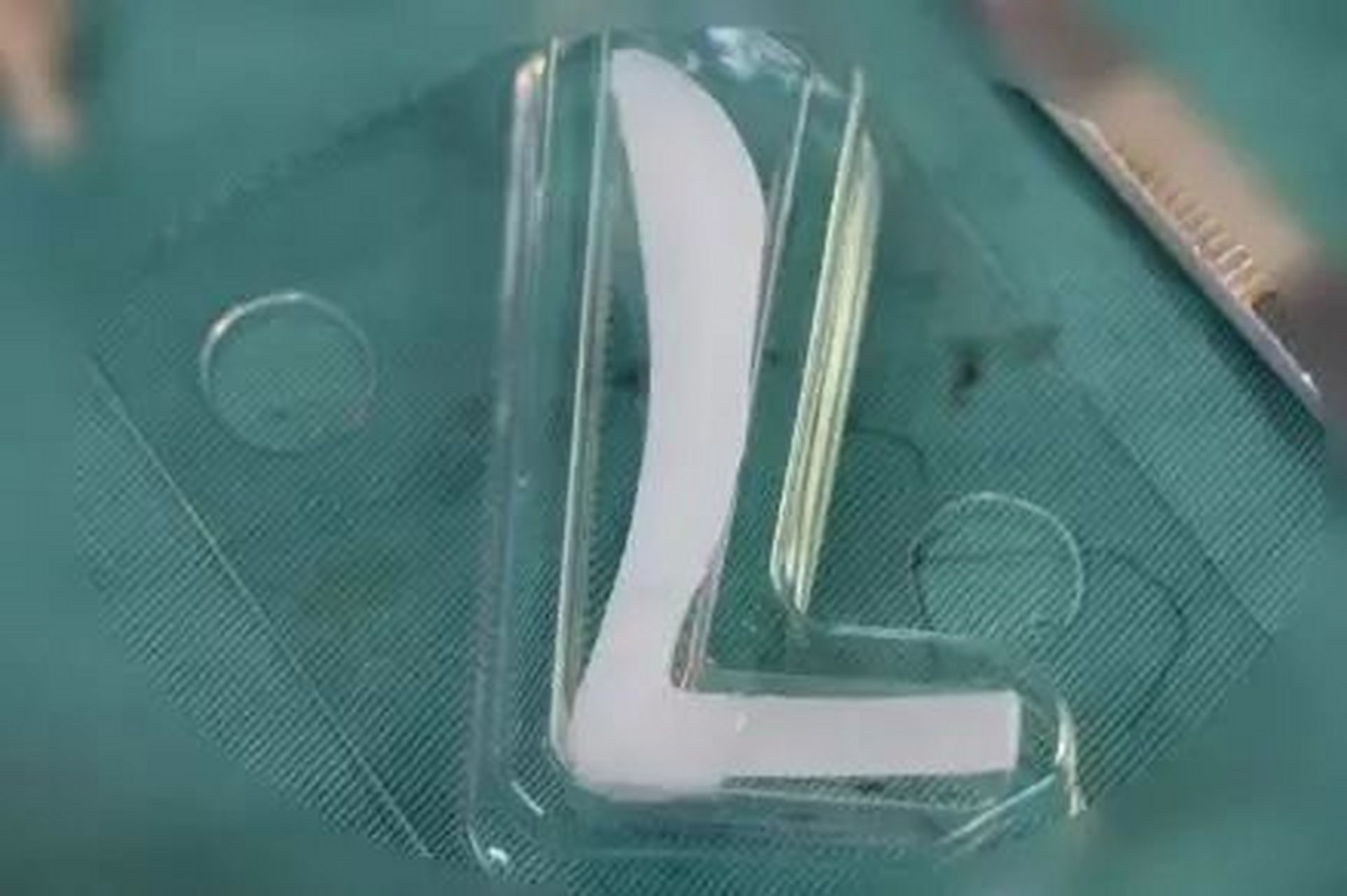 之所以有人会说硅胶假体定期更换,是因为硅胶长时间在人体内会可能