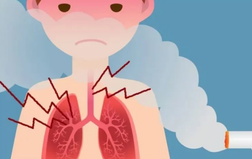 医生提醒:肺不舒服的人,喉咙可能有这2个表现,不妨了解一下