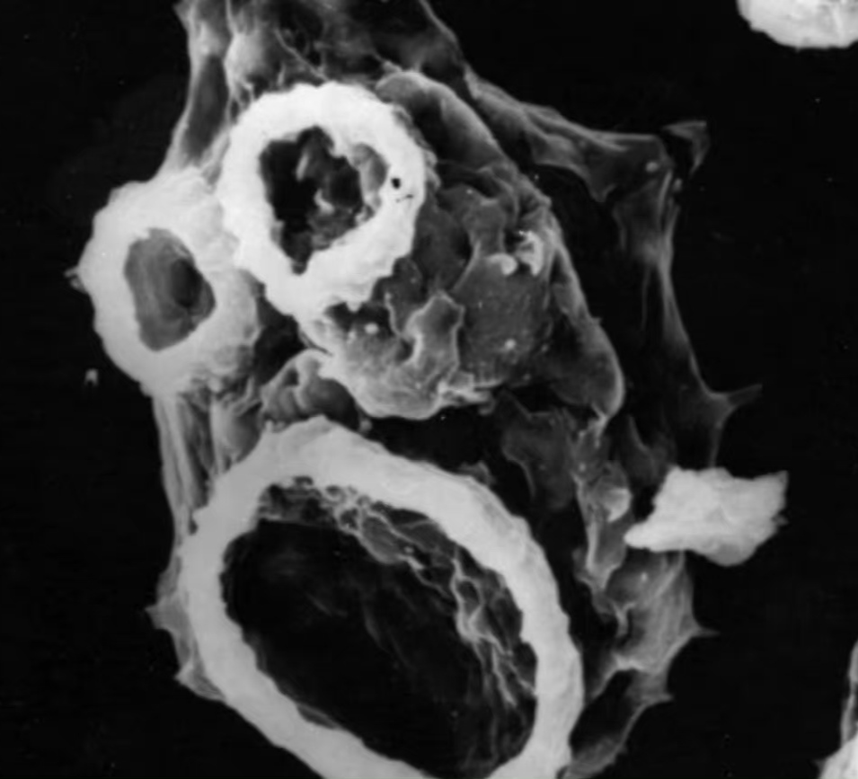 原名阿米巴原虫,它们通常生活在温暖的淡水和土壤中,常见于25°c