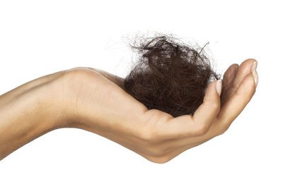 病理性脱发的判断与治疗方法