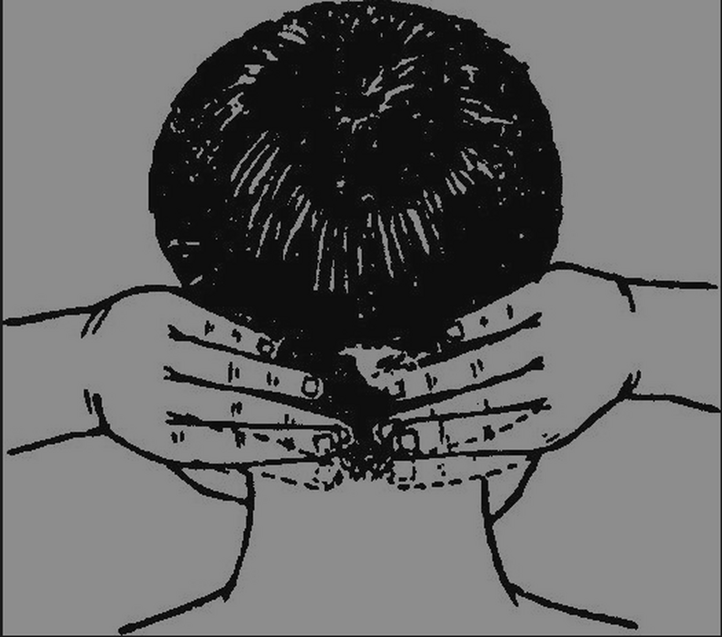 鸣天鼓法防治耳聋,耳鸣: 调整好呼吸,用两手掌心紧贴两外耳道口,两手