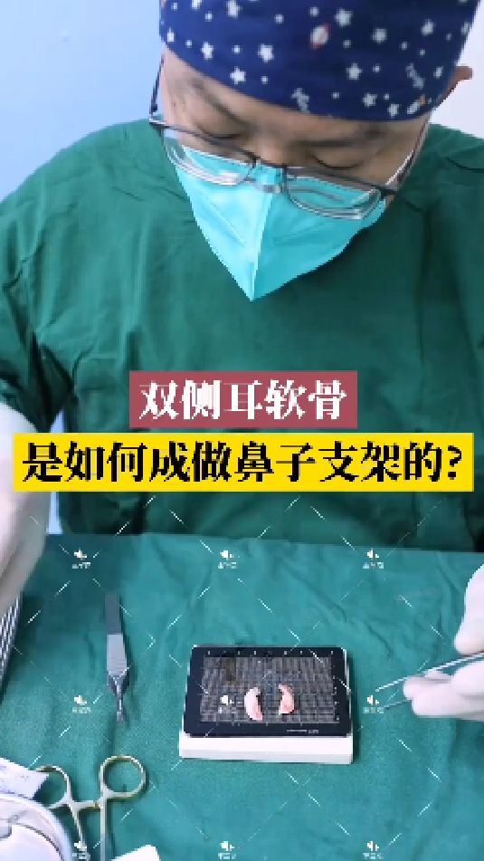 隆鼻手术中,耳软骨是如何做成鼻子支架的?看手术室内实拍