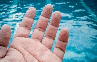 我的手指为什么有那么多皱纹为什么在线 我的手指为什么有那么多皱纹为什么在线