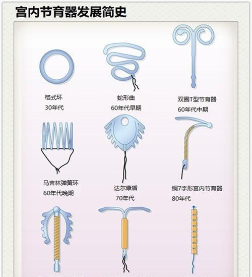 节育环一直不取,会长到肉里吗?即使再怕疼也尽量按时取出来