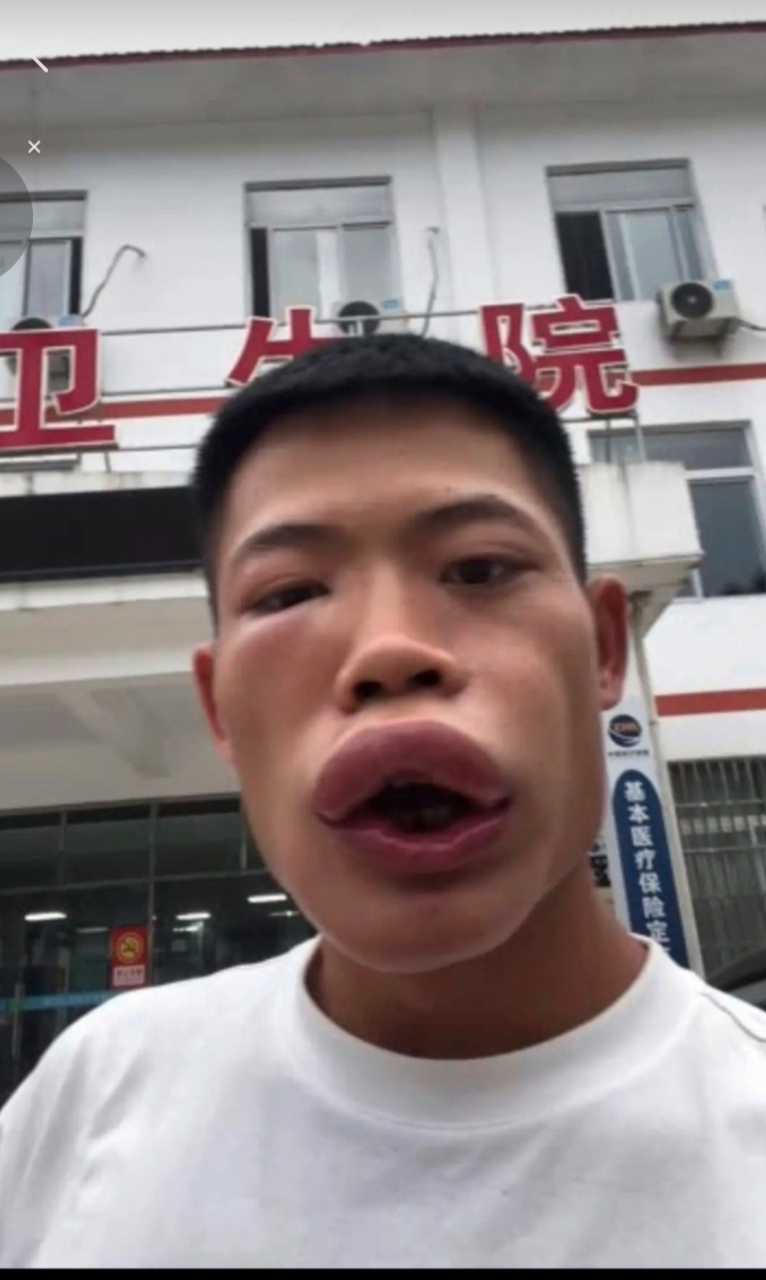 吃完芒果03,我就变成这样了.#搞笑日常