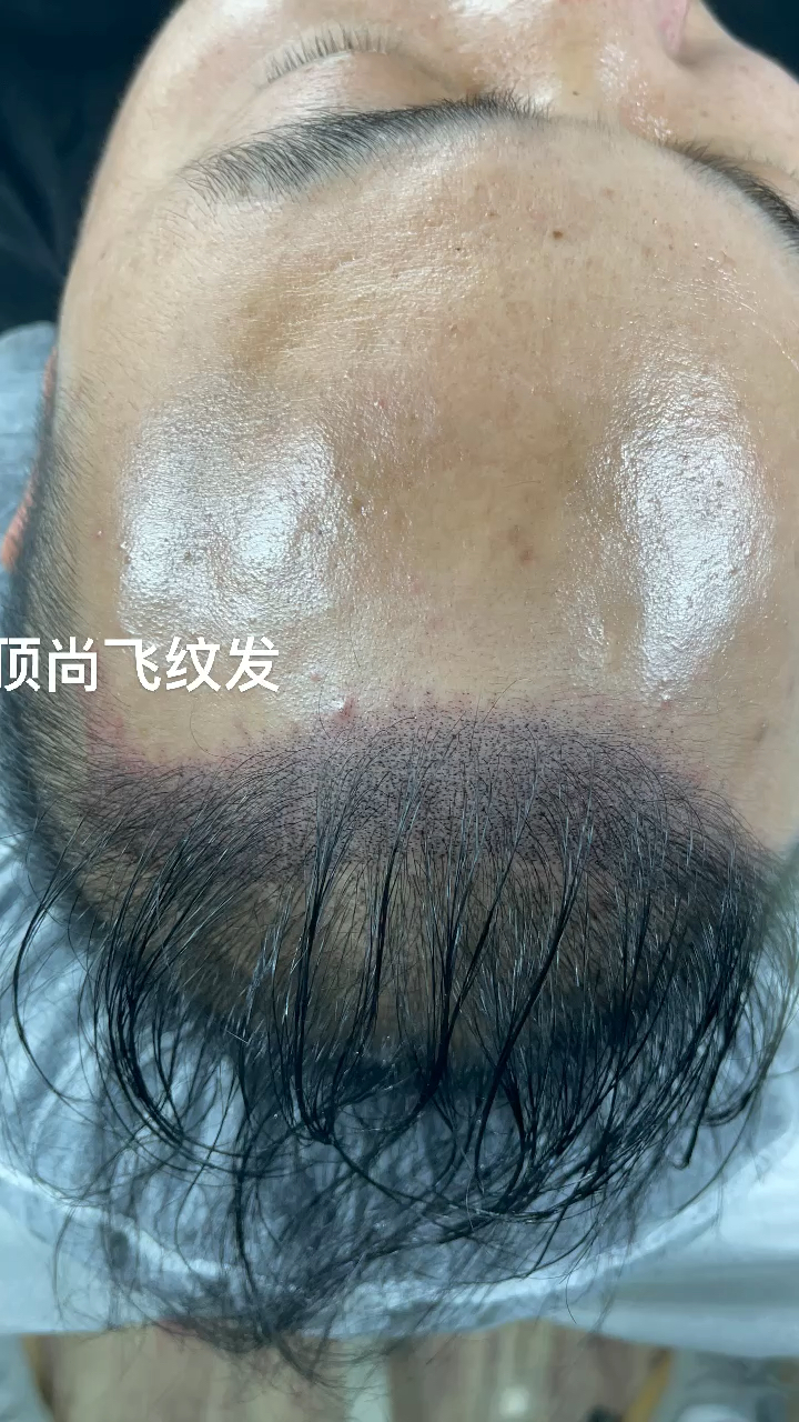 纹发3d效果,逼真而自然,摆脱秃秃困扰